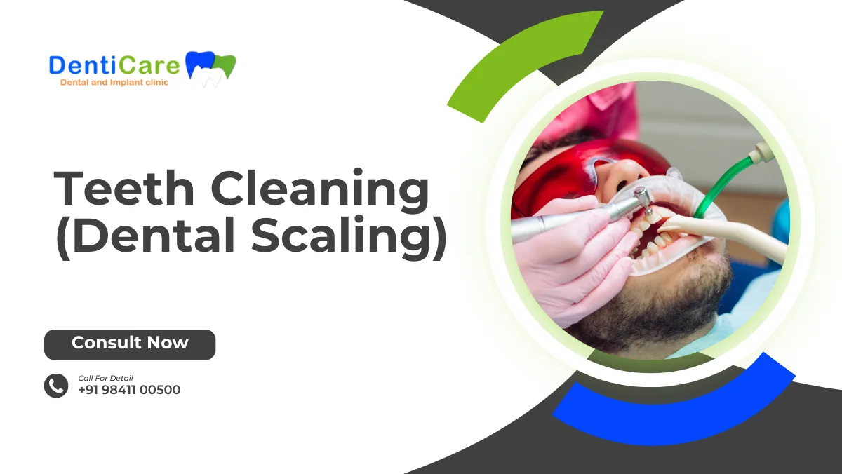Teeth Cleaning (Dental Scaling)
