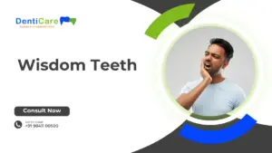 Wisom Teeth