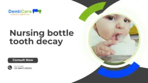 Nursing bottle tooth decay