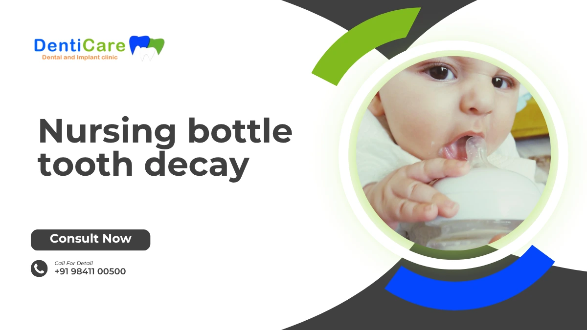 Nursing bottle tooth decay