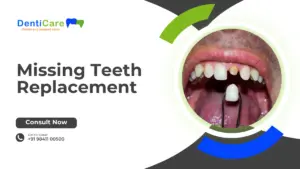 Missing Teeth Replacement
