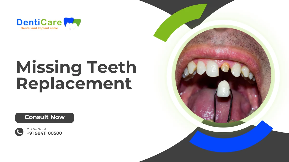 Missing Teeth Replacement