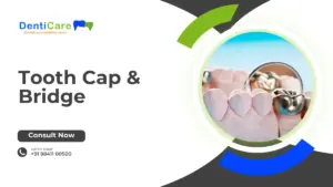 Tooth Cap & Bridge
