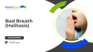 Chapter 19 - Bad Breath(Halitosis)