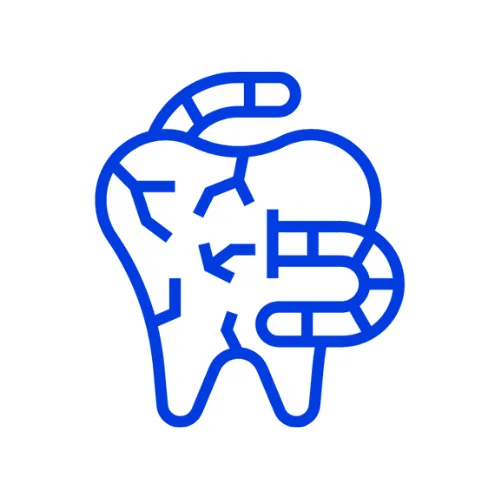Bone Grafting