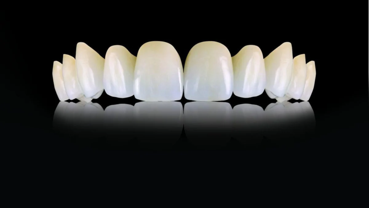 E Max Crowns