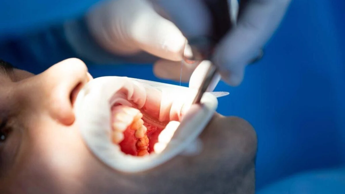 MINOR ORAL SURGERY