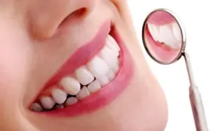 FULL MOUTH REHABLITATION