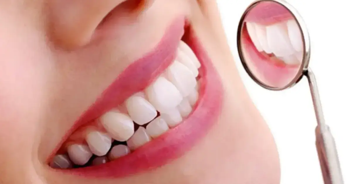 Full Mouth Rehabilitation