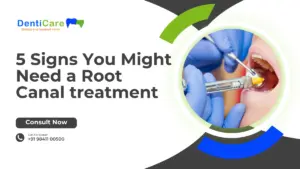 5 Signs You Might Need a Root Canal treatment