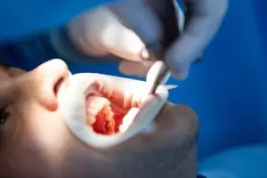 minor oral surgery