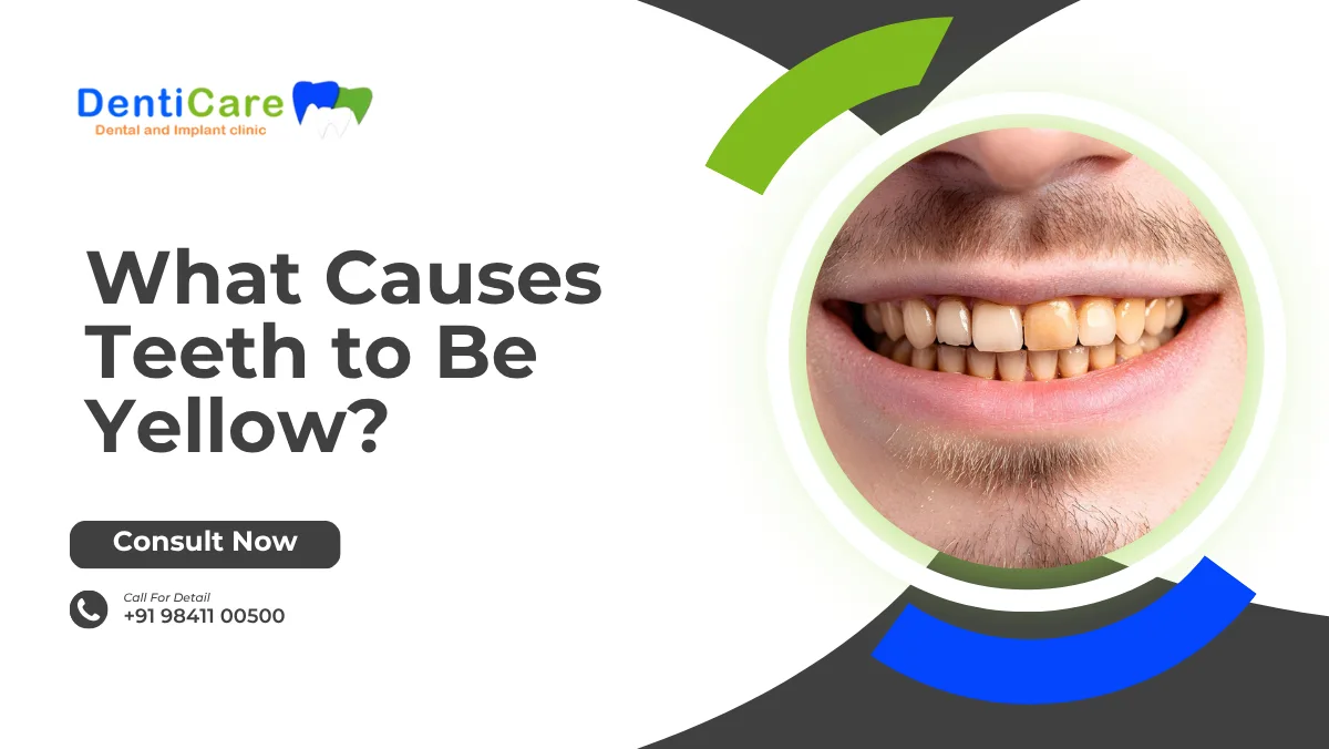 What Causes Teeth to Be Yellow? Top Reasons and How to Fix Them