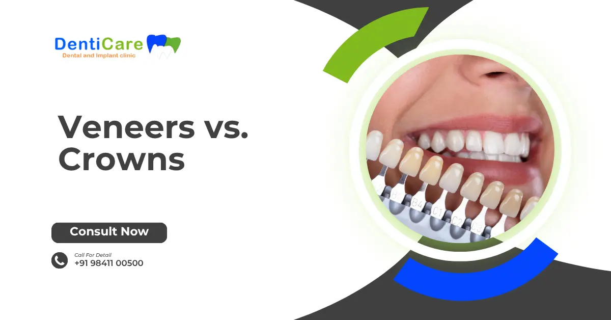 Veneers vs. Crowns: Which Cosmetic Fix Is Right for You?