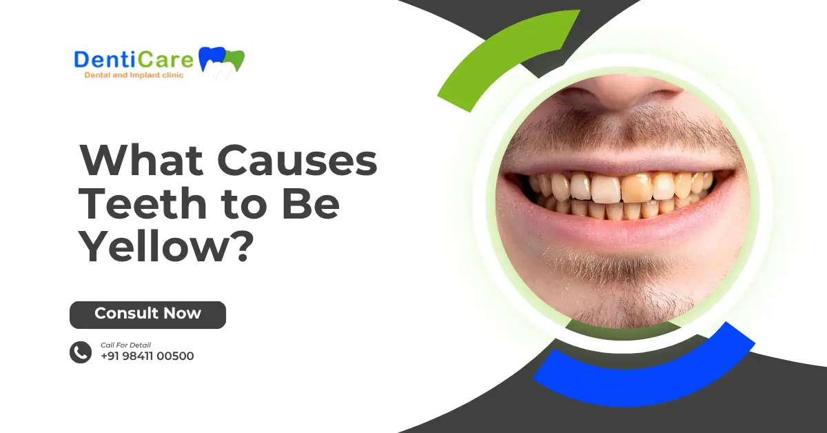 What Causes Teeth to Be Yellow