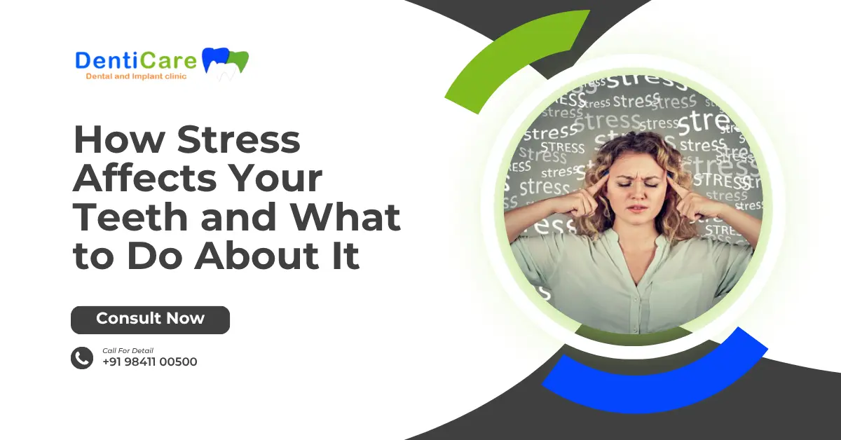 Chapter 24 - How Stress Affects Your Teeth and What to Do About It