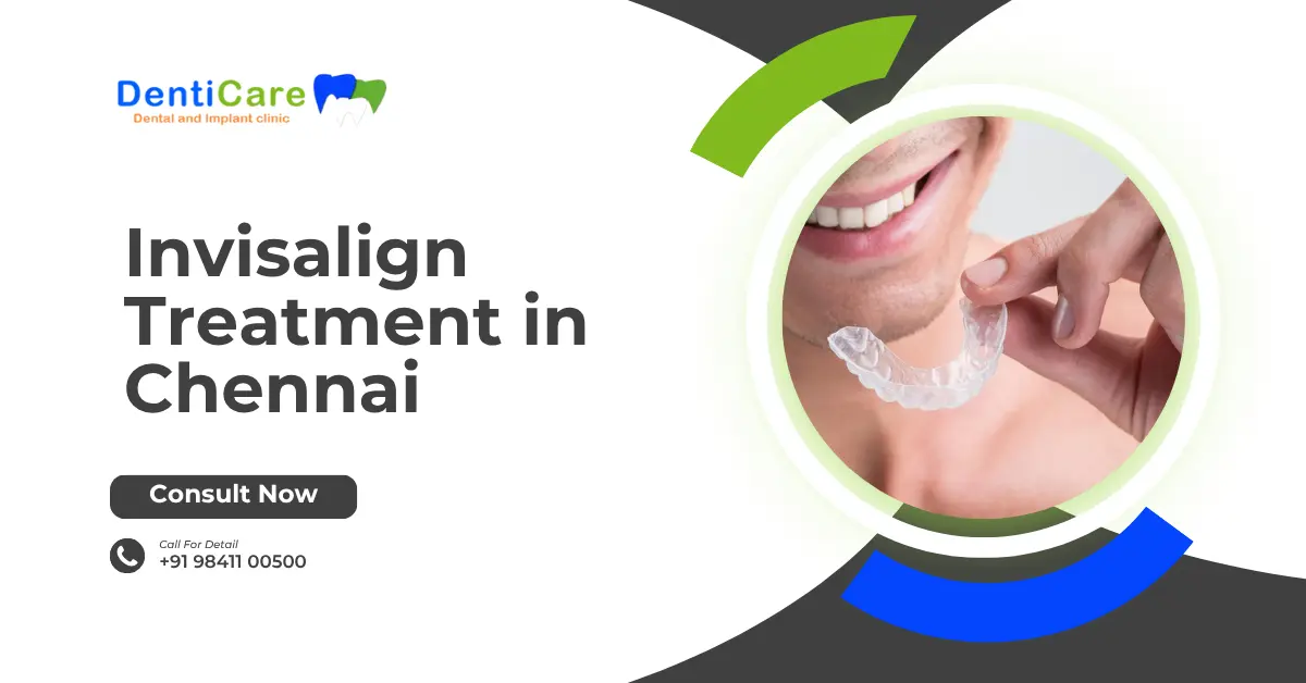 Invisalign Treatment in Chennai
