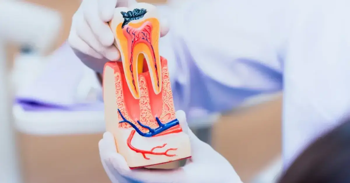 Root Canal Treatment