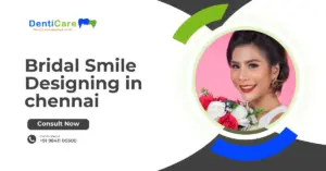 Bridal Smile Designing in chennai