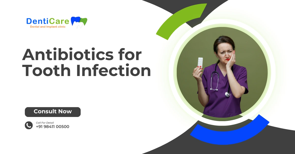 Antibiotics for Tooth Infection