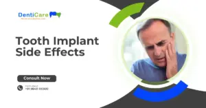 Tooth Implant Side Effects