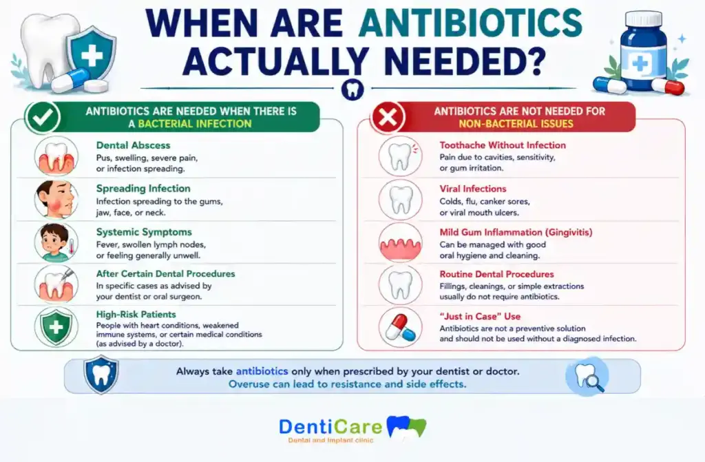 antibiotics for tooth infection