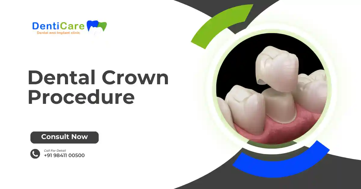 Dental Crown Procedure