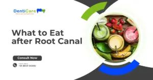 What to Eat after Root Canal