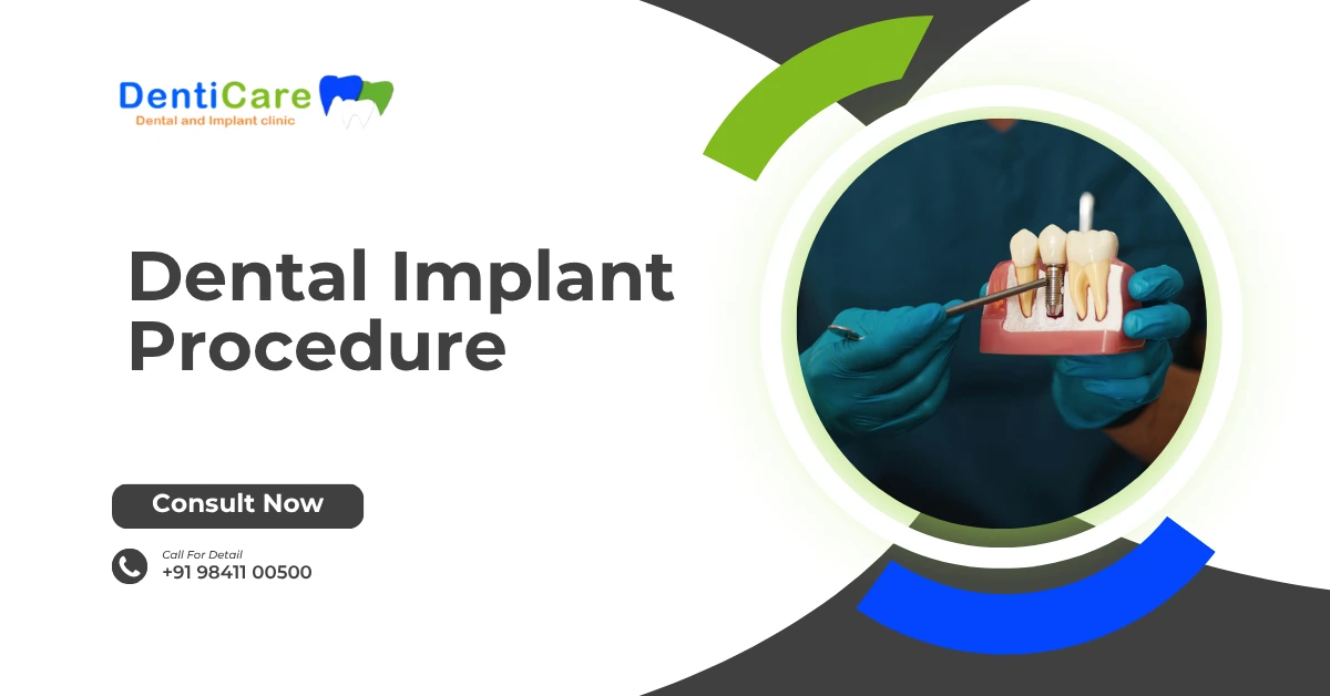 Dental Implant Procedure