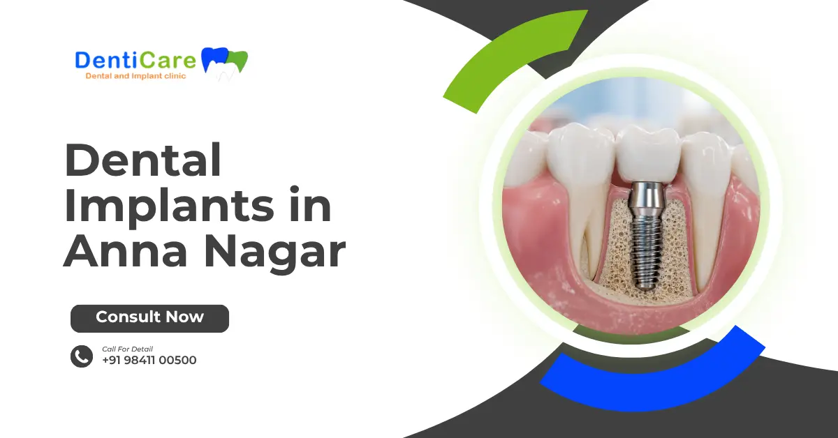 Dental Implants in Anna Nagar