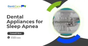 Dental Appliances for Sleep Apnea