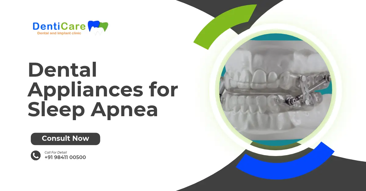 Dental Appliances for Sleep Apnea